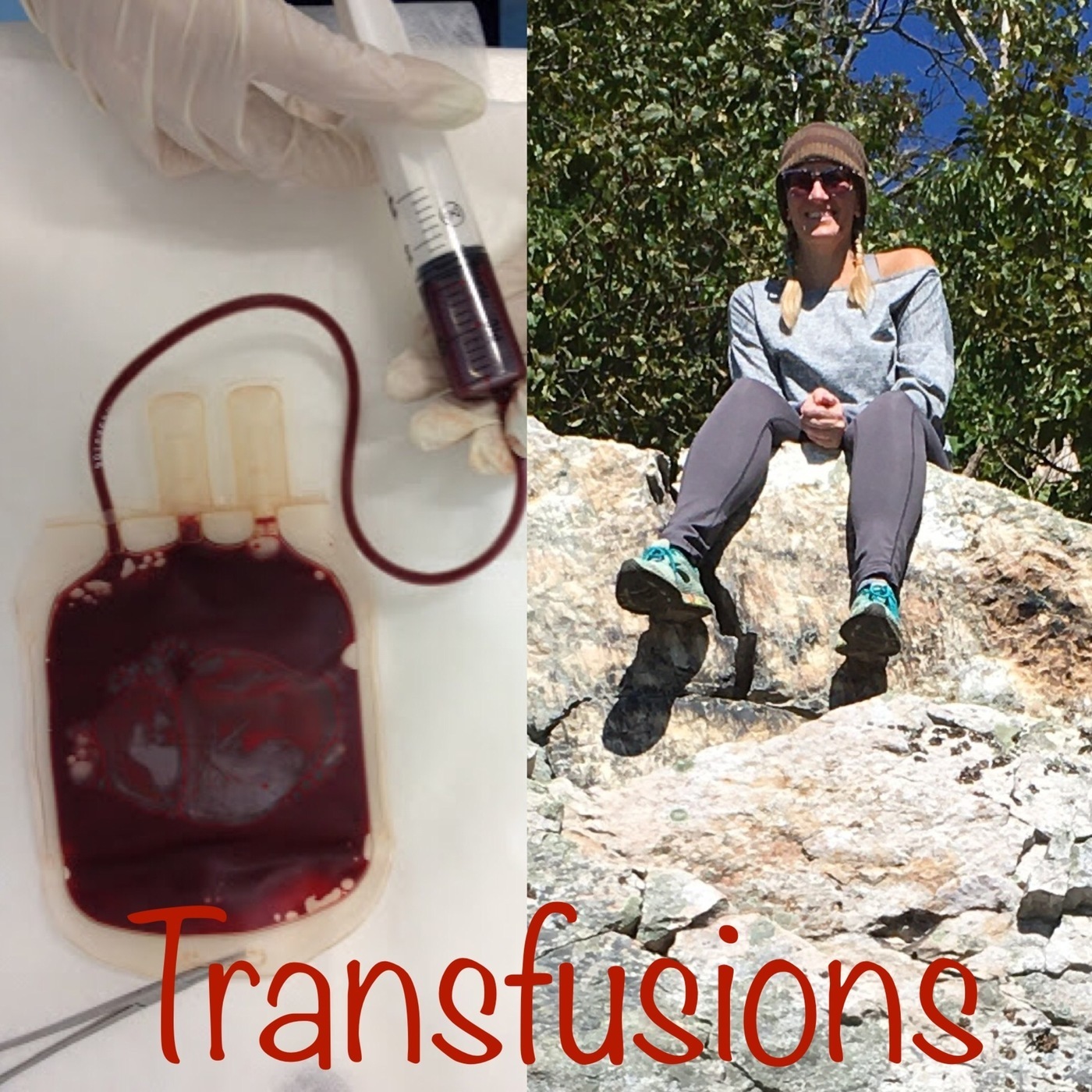 Vet Talk #34-Transfusions