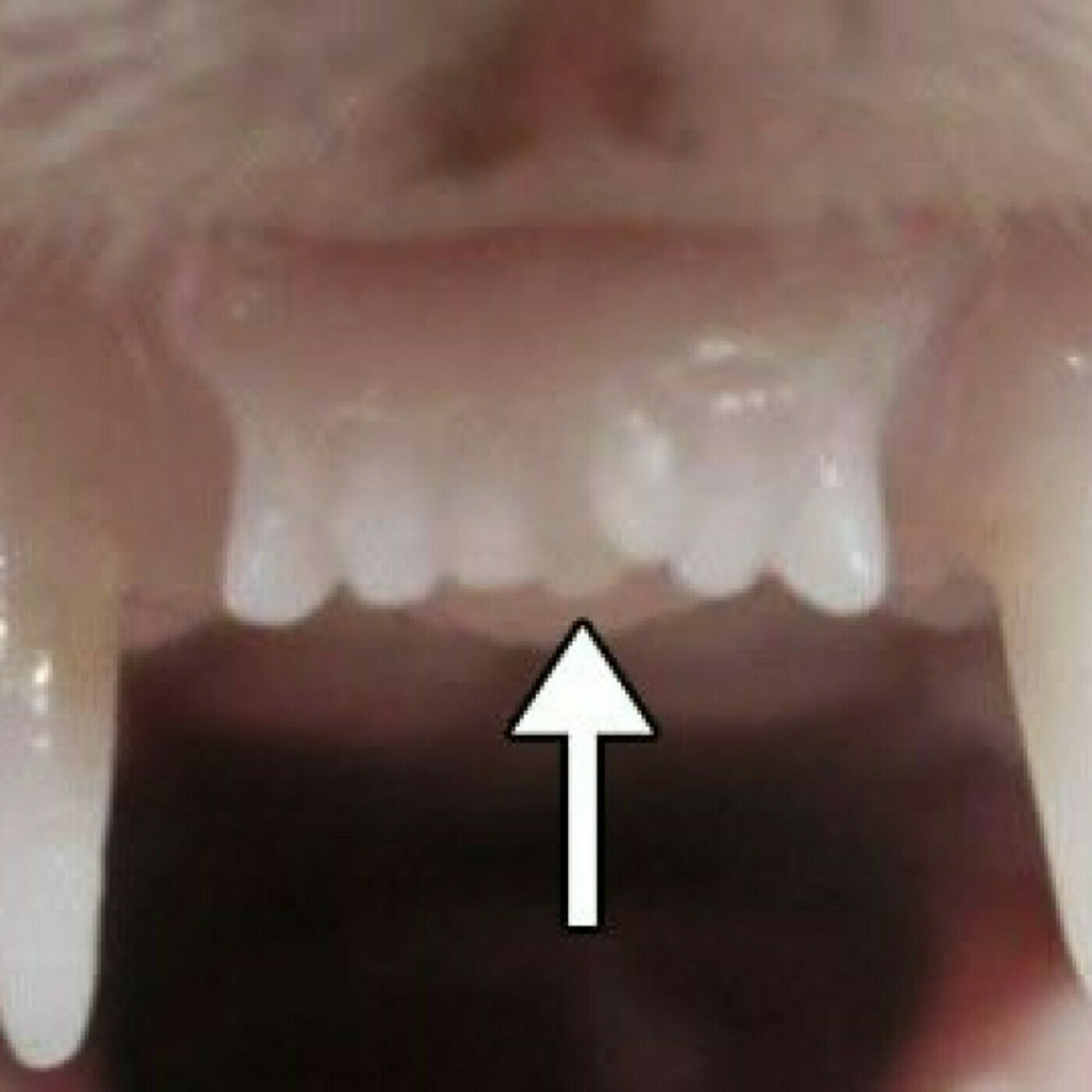 Toothdráma
